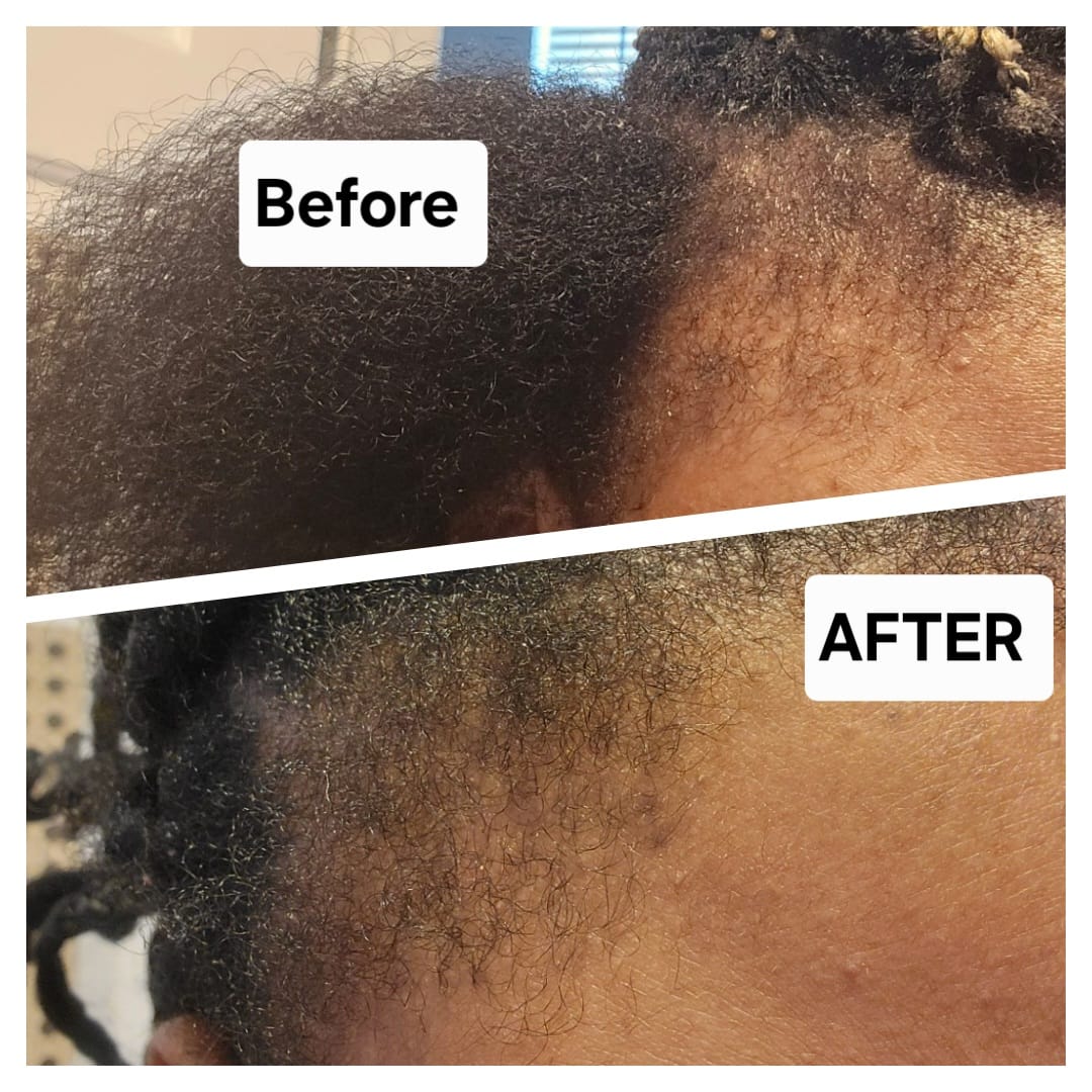 ZAS-LUMINA HAIR GROWTH ELIXIR Stimulates Growth • Seals Moisture • Strengthens Roots.