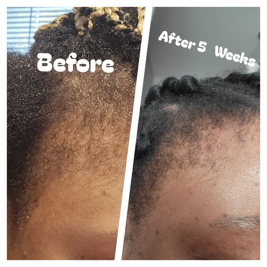 Organic Hair Growth Oil. Natural Formula for Fuller, Healthier Hair, Strengthen, Nourish & Restore Naturally.
