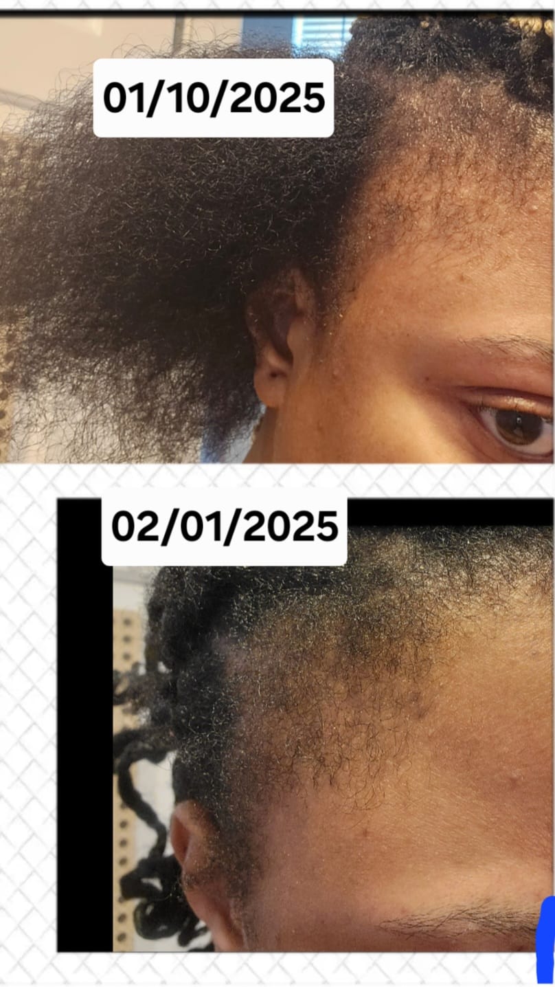 ZAS-LUMINA Hair Growth Oil: Strengthen Roots, Nourish Strands, and Restore Natural Vitality for Fuller, Healthier Hair.