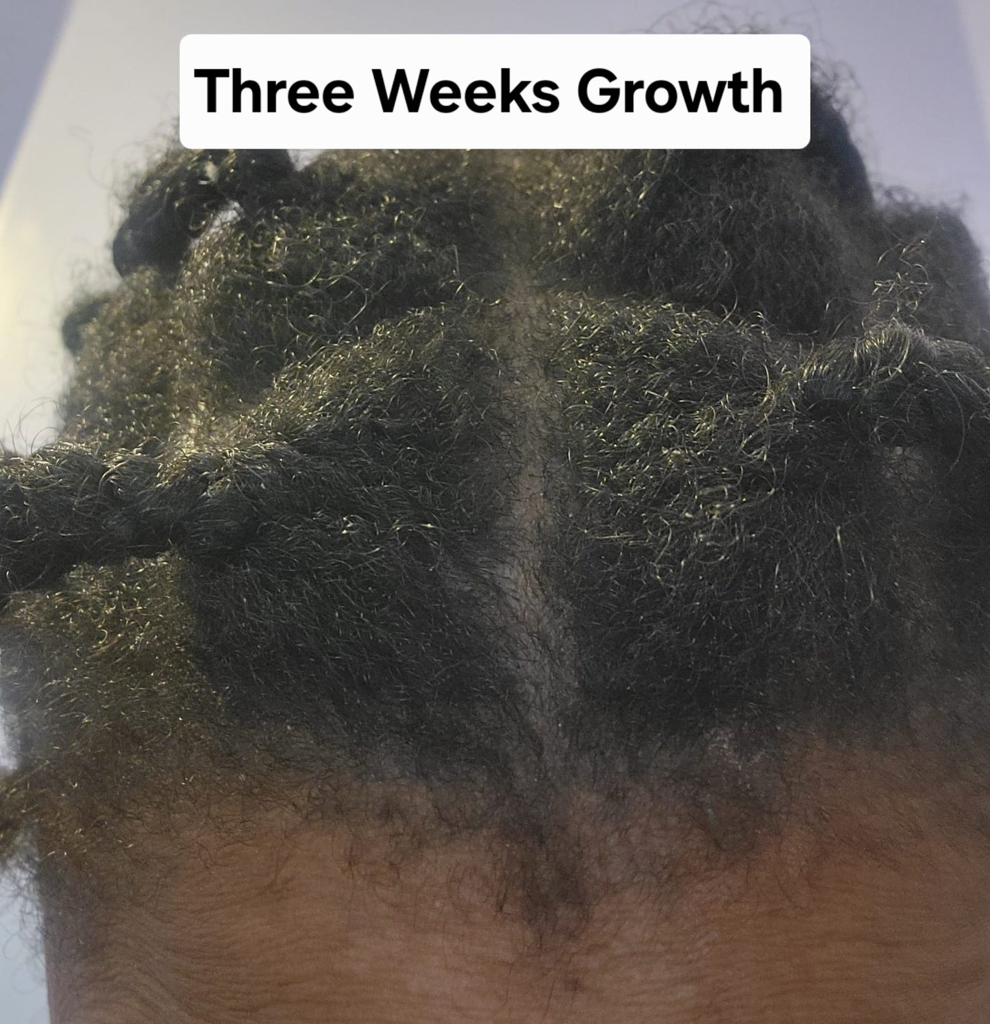 ZAS-LUMINA Hair Growth Oil: Strengthen Roots, Nourish Strands, and Restore Natural Vitality for Fuller, Healthier Hair.