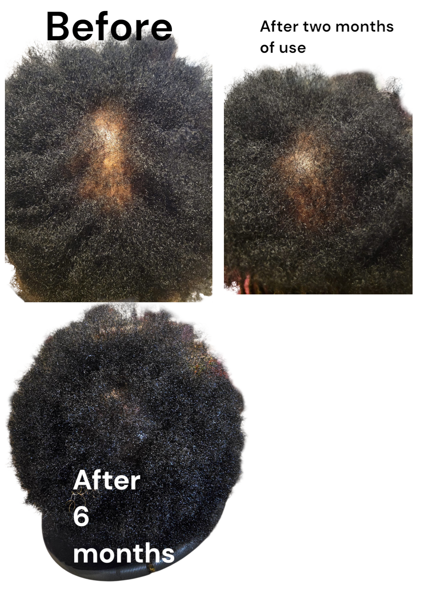 ZAS-LUMINA Hair Growth Oil: Strengthen Roots, Nourish Strands, and Restore Natural Vitality for Fuller, Healthier Hair.