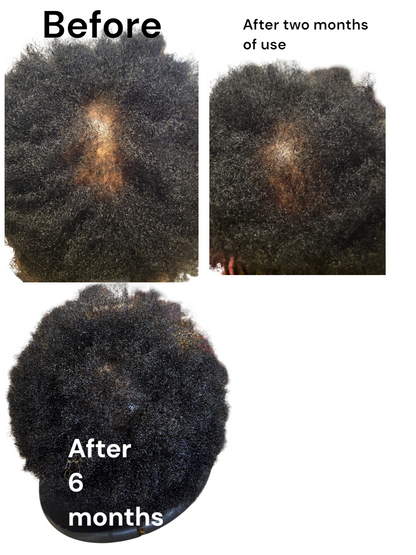 ZAS-LUMINA Hair Growth Oil: Strengthen Roots, Nourish Strands, and Restore Natural Vitality for Fuller, Healthier Hair.