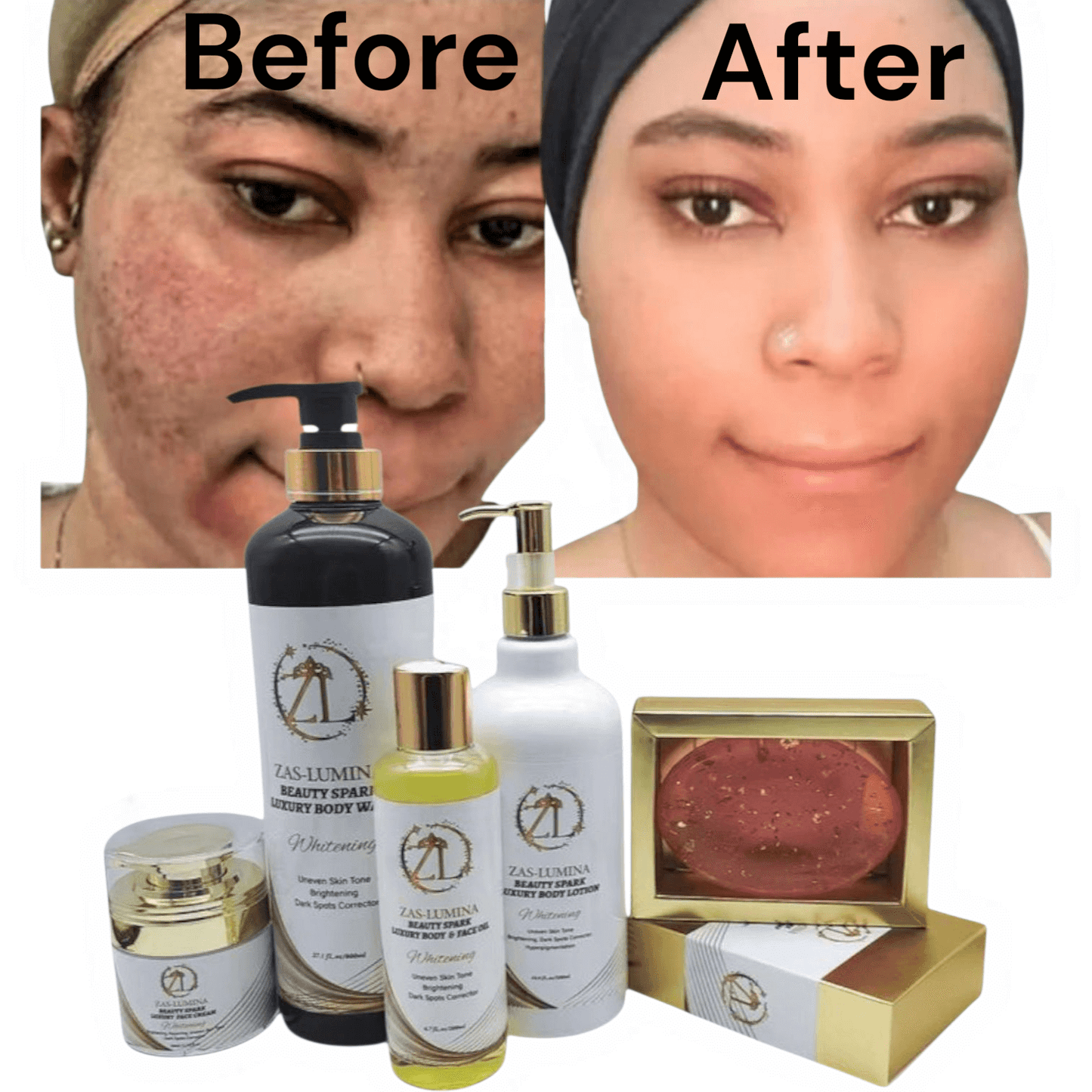 ZAS-LUMINA Beauty Spark Body Lotion – 5-Piece Glow Set For a Balanced, Glowing Complexion / Lightweight, Non-Greasy Moisture